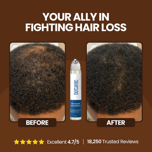 Rosemary Hair Growth Roll-On Serum