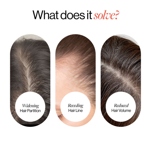 Roll-On Hair Regrowth Serum