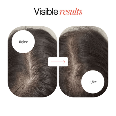 Roll-On Hair Regrowth Serum