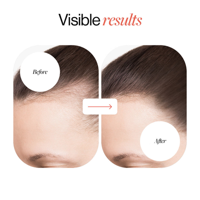 Roll-On Hair Regrowth Serum