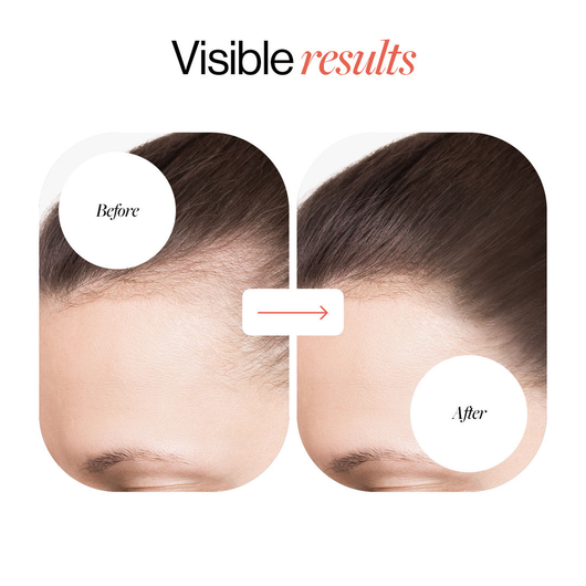 Roll-On Hair Regrowth Serum