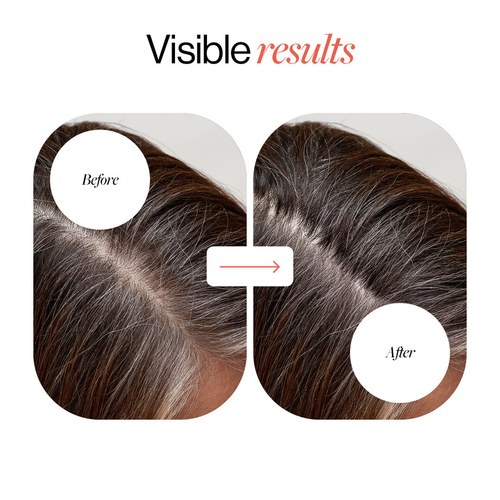 Roll-On Hair Regrowth Serum